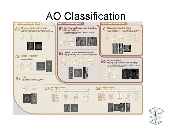 AO Classification 