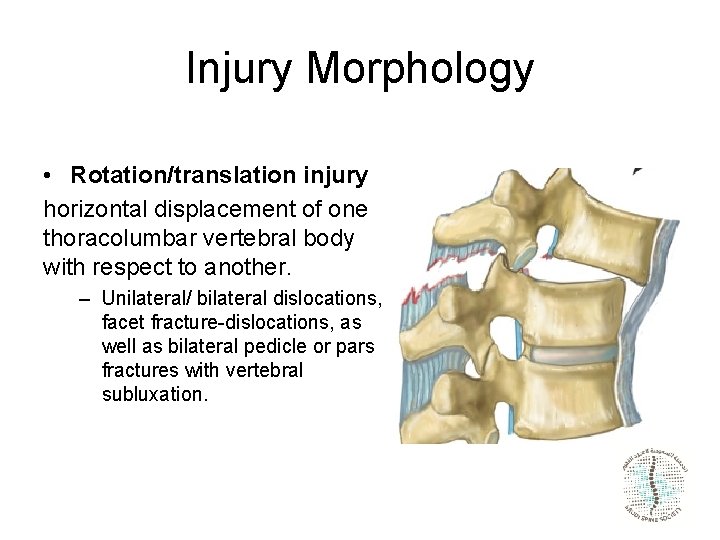 Injury Morphology • Rotation/translation injury horizontal displacement of one thoracolumbar vertebral body with respect