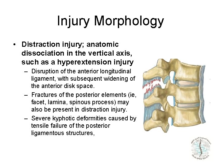 Injury Morphology • Distraction injury; anatomic dissociation in the vertical axis, such as a