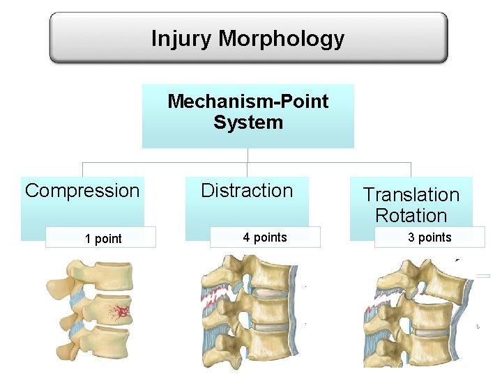 Injury Morphology Mechanism-Point System Compression 1 point Distraction 4 points Translation Rotation 3 points