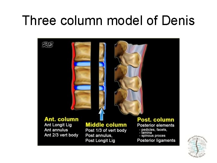 Three column model of Denis 