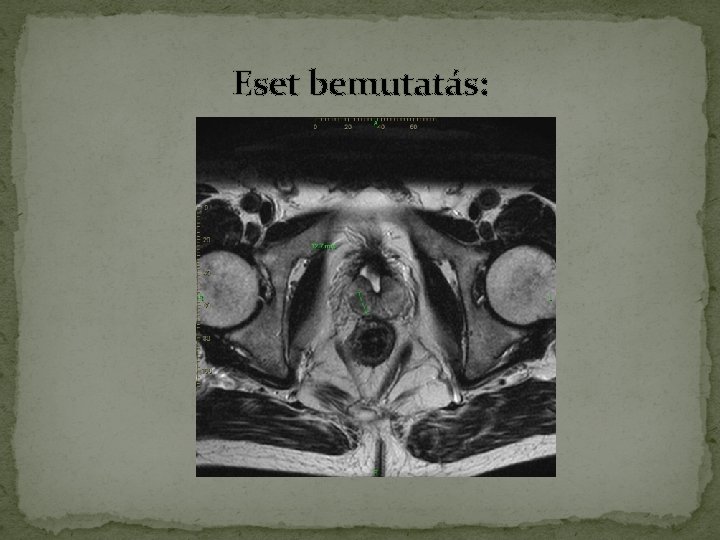 Eset bemutatás: Eset bemutatás: