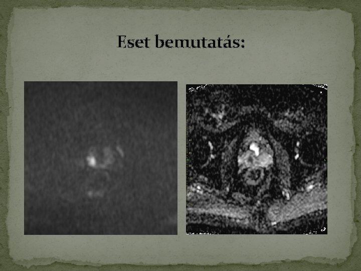 Eset bemutatás: Eset bemutatás: