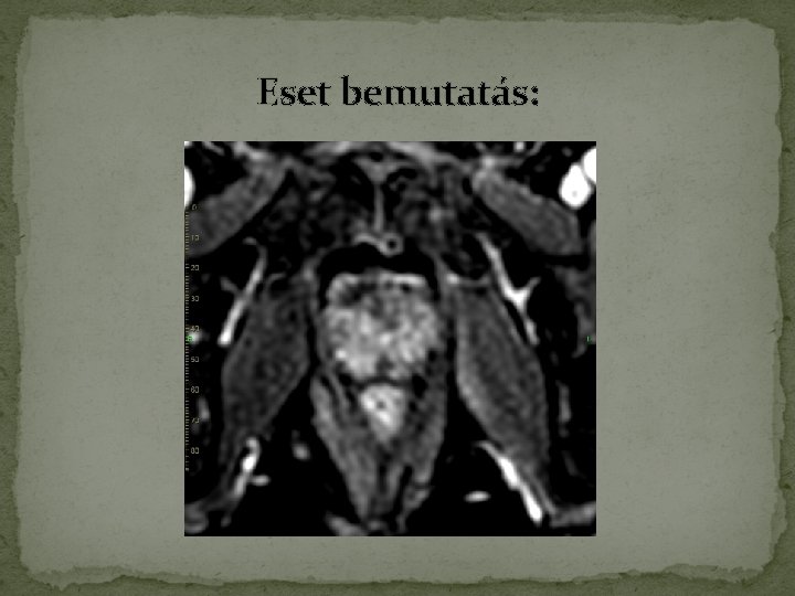 Eset bemutatás: Eset bemutatás: