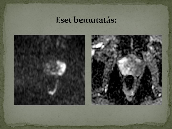 Eset bemutatás: Eset bemutatás: