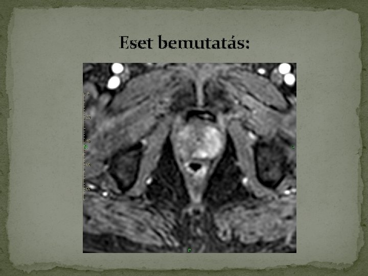 Eset bemutatás: Eset bemutatás: