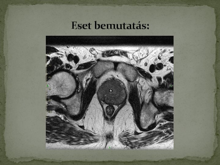 Eset bemutatás: Eset bemutatás: