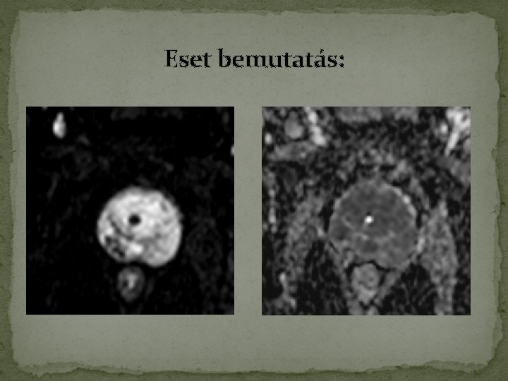 Eset bemutatás: Eset bemutatás: