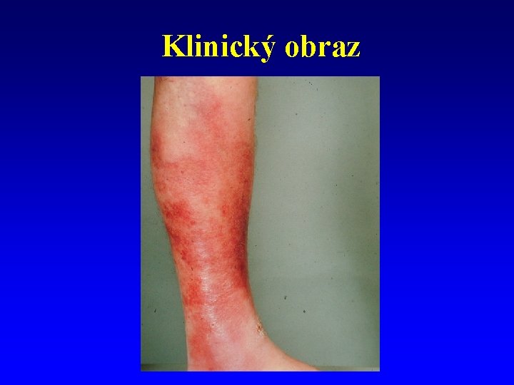 Klinický obraz 