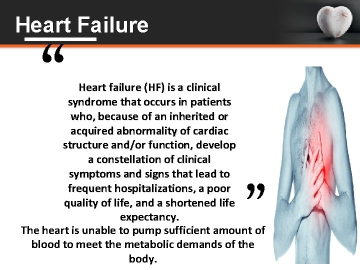 “ Heart Failure Heart failure (HF) is a clinical syndrome that occurs in patients