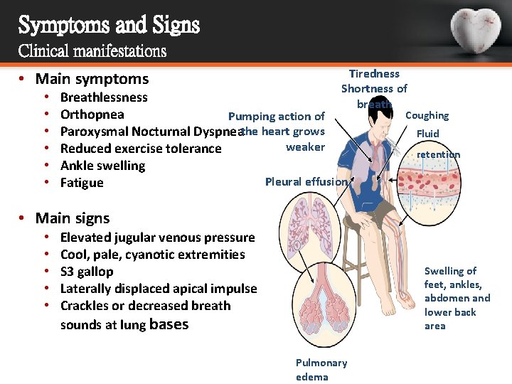Symptoms and Signs Clinical manifestations • Main symptoms • • • Tiredness Shortness of