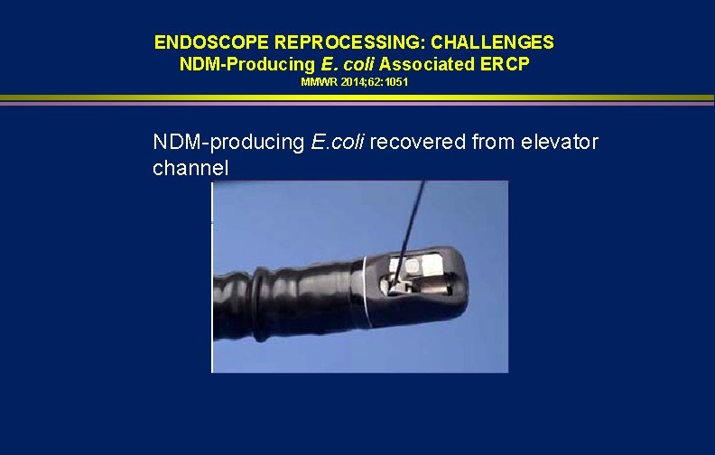 ENDOSCOPE REPROCESSING: CHALLENGES NDM-Producing E. coli Associated ERCP MMWR 2014; 62: 1051 NDM-producing E.