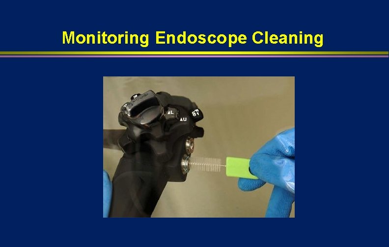 Monitoring Endoscope Cleaning 
