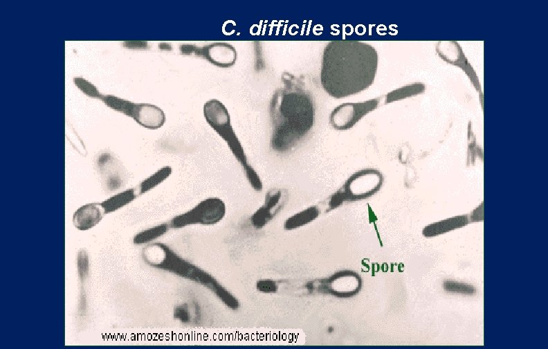 C. difficile spores 