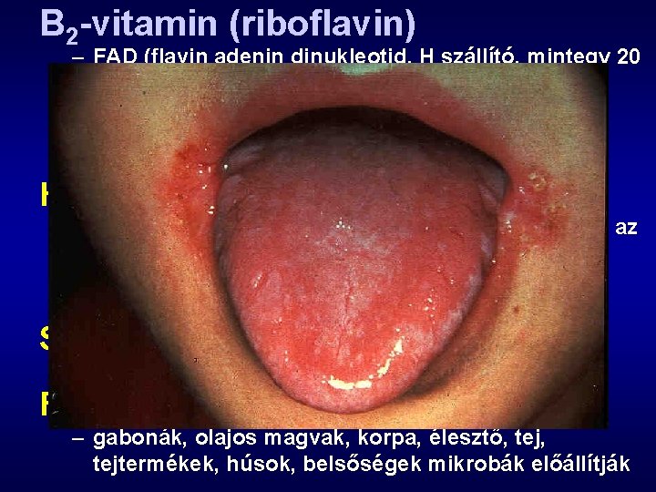 B 2 -vitamin (riboflavin) – FAD (flavin adenin dinukleotid, H szállító, mintegy 20 enzim