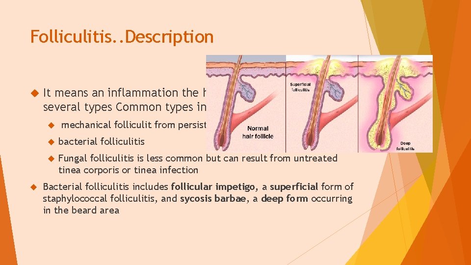 Folliculitis. . Description It means an inflammation the hair follicle and there are several