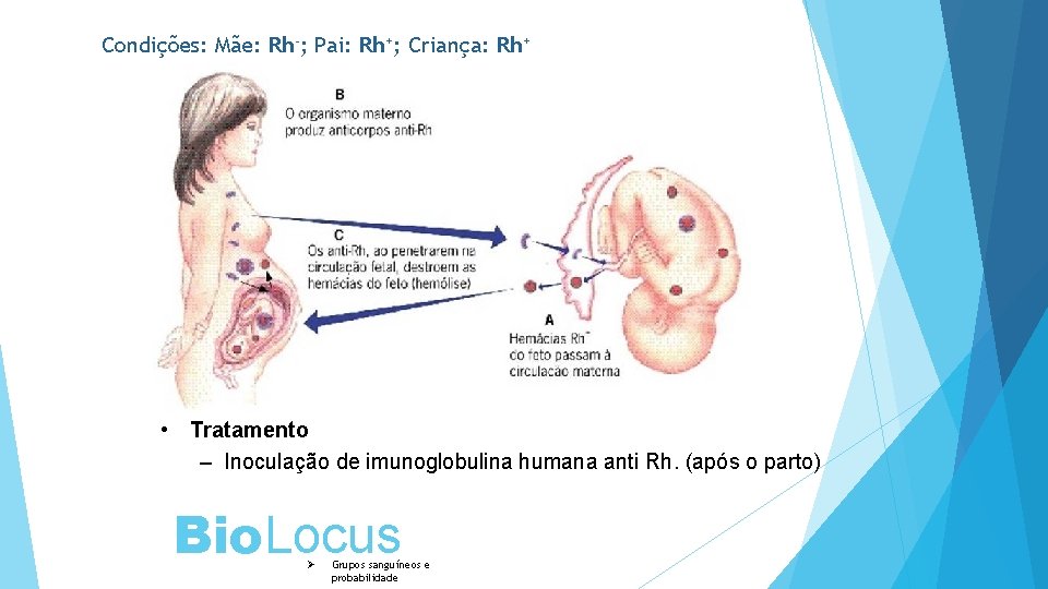 Condições: Mãe: Rh-; Pai: Rh+; Criança: Rh+ • Tratamento – Inoculação de imunoglobulina humana