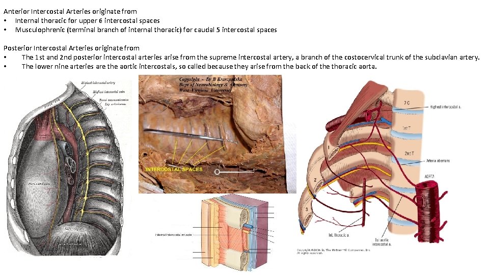 Anterior Intercostal Arteries originate from • Internal thoracic for upper 6 intercostal spaces •