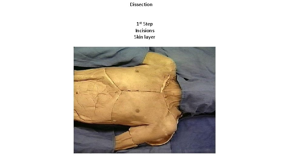 Dissection 1 st Step Incisions Skin layer 