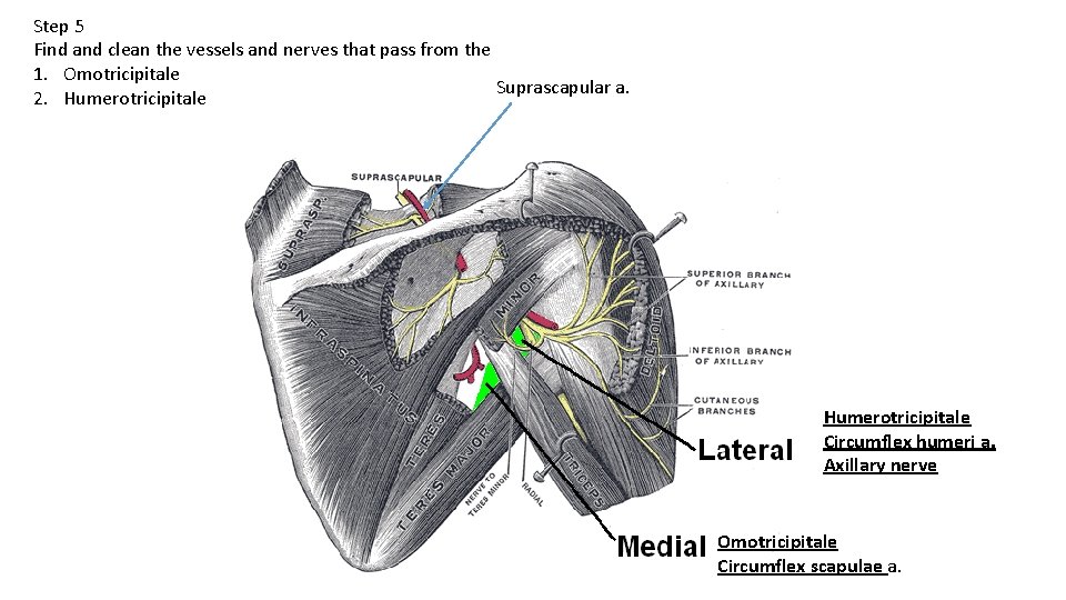 Step 5 Find and clean the vessels and nerves that pass from the 1.