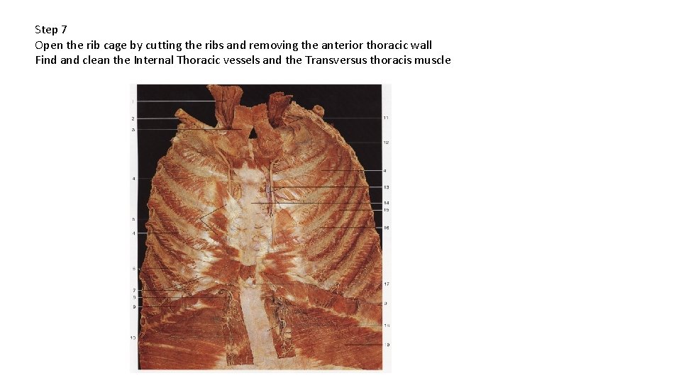 Step 7 Open the rib cage by cutting the ribs and removing the anterior