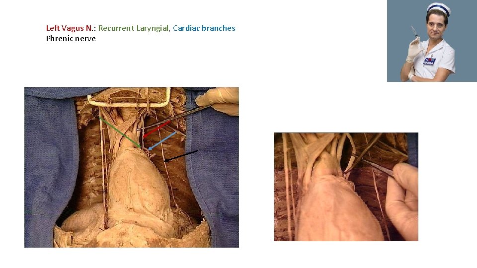 Left Vagus N. : Recurrent Laryngial, Cardiac branches Phrenic nerve 