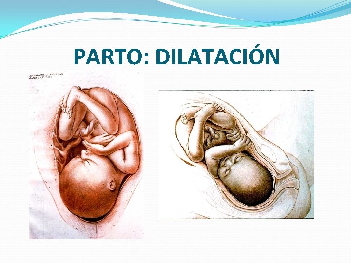 PARTO: DILATACIÓN 