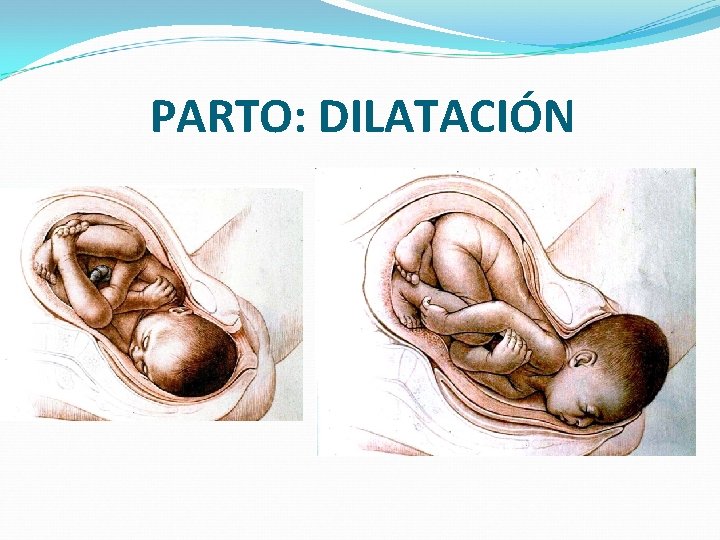 PARTO: DILATACIÓN 