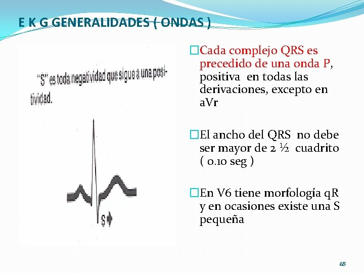 E K G GENERALIDADES ( ONDAS ) �Cada complejo QRS es precedido de una