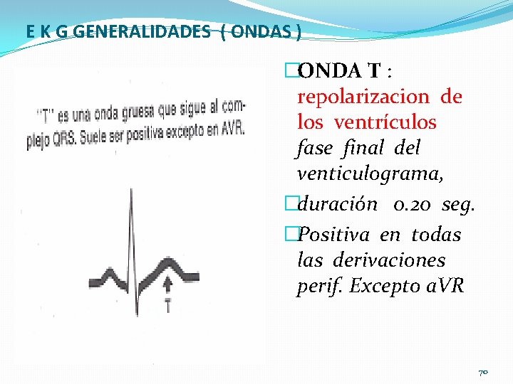 E K G GENERALIDADES ( ONDAS ) �ONDA T : repolarizacion de los ventrículos