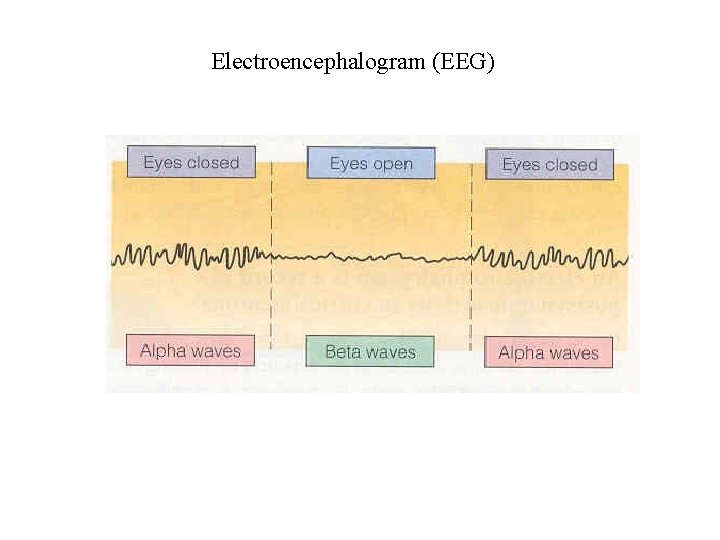 Electroencephalogram (EEG) Electroencephalogram (EEG)
