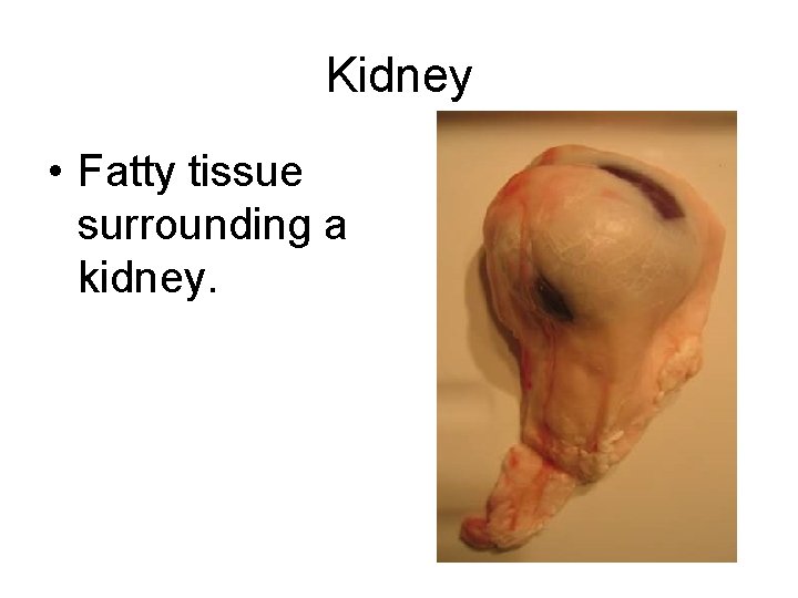 Kidney • Fatty tissue surrounding a kidney. 