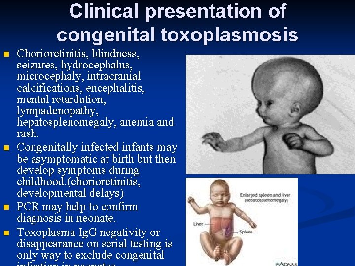 Clinical presentation of congenital toxoplasmosis n n Chorioretinitis, blindness, seizures, hydrocephalus, microcephaly, intracranial calcifications,