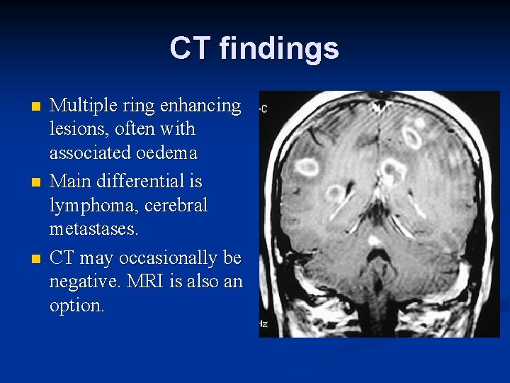 CT findings n n n Multiple ring enhancing lesions, often with associated oedema Main