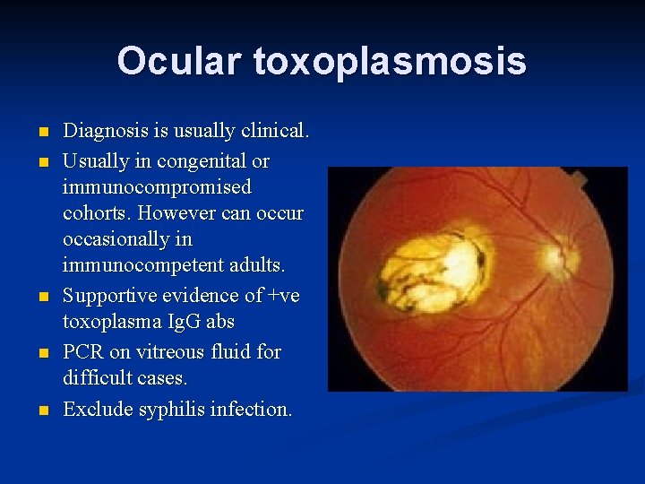 Ocular toxoplasmosis n n n Diagnosis is usually clinical. Usually in congenital or immunocompromised