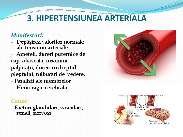  3. HIPERTENSIUNEA ARTERIALA Manifestări: - Depăşirea valorilor normale tensiunii arteriale - Ameţeli, dureri