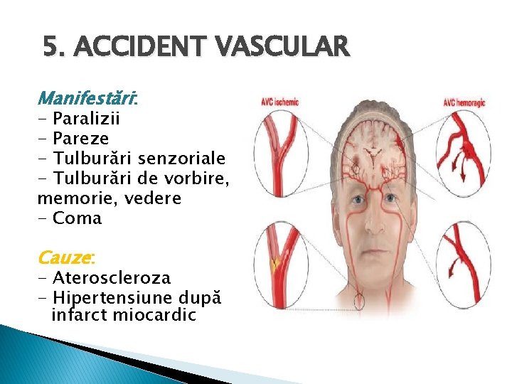 5. ACCIDENT VASCULAR Manifestări: - Paralizii - Pareze - Tulburări senzoriale - Tulburări de