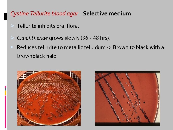 Cystine Tellurite blood agar - Selective medium Ø Tellurite inhibits oral flora. Ø C.