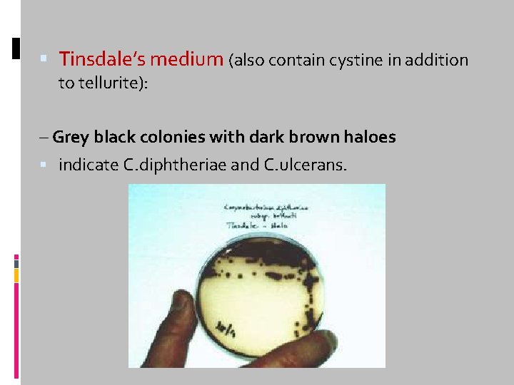  Tinsdale’s medium (also contain cystine in addition to tellurite): – Grey black colonies