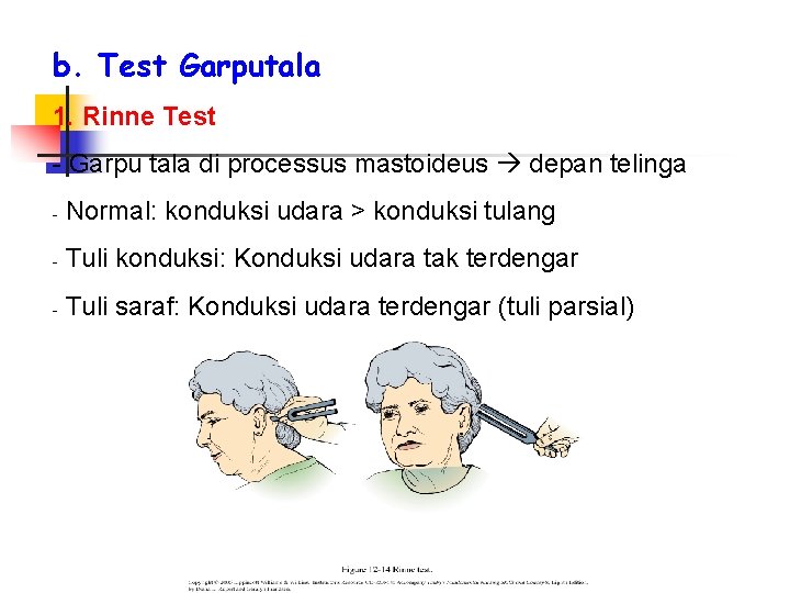 b. Test Garputala 1. Rinne Test - Garpu tala di processus mastoideus depan telinga