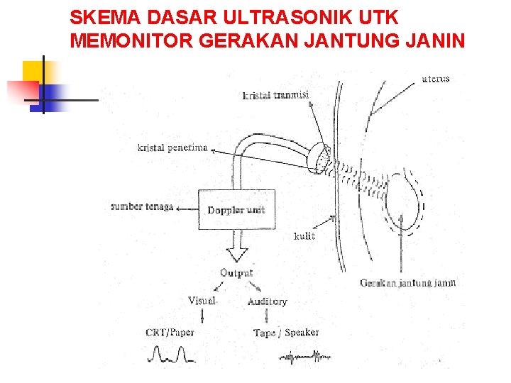 SKEMA DASAR ULTRASONIK UTK MEMONITOR GERAKAN JANTUNG JANIN 