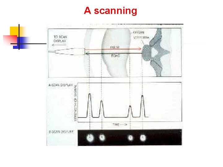 A scanning 