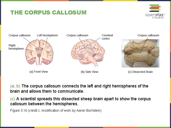 THE CORPUS CALLOSUM (a, b) The corpus callosum connects the left and right hemispheres