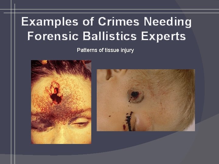 Examples of Crimes Needing Forensic Ballistics Experts Patterns of tissue injury 