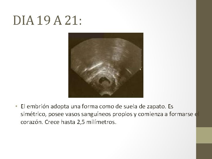 DIA 19 A 21: • El embrión adopta una forma como de suela de
