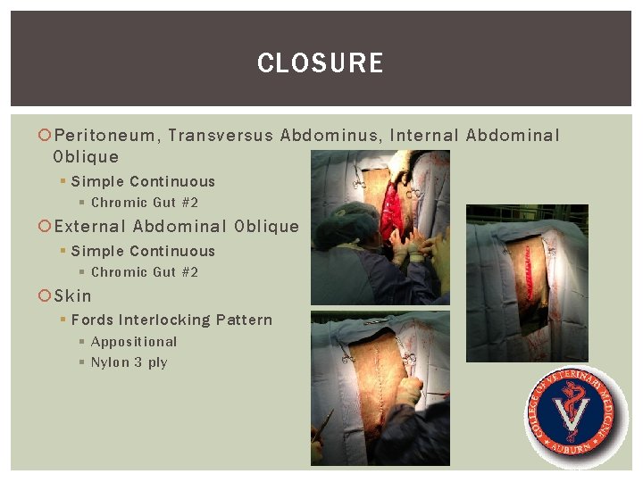 CLOSURE Peritoneum, Transversus Abdominus, Internal Abdominal Oblique § Simple Continuous § Chromic Gut #2