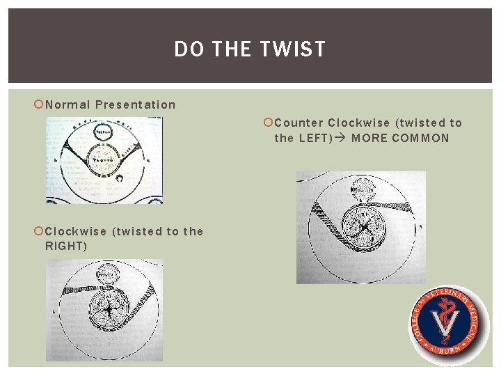 DO THE TWIST Normal Presentation Counter Clockwise (twisted to the LEFT) MORE COMMON Clockwise