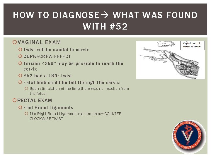 HOW TO DIAGNOSE WHAT WAS FOUND WITH #52 VAGINAL EXAM Twist will be caudal