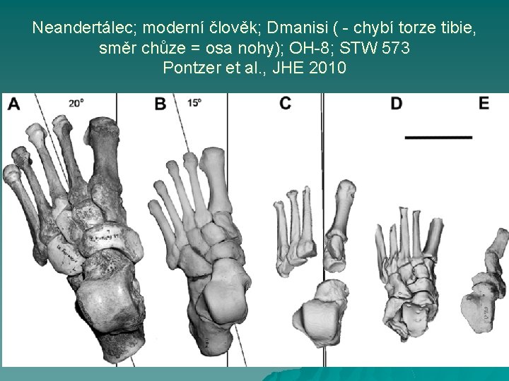 Neandertálec; moderní člověk; Dmanisi ( - chybí torze tibie, směr chůze = osa nohy);