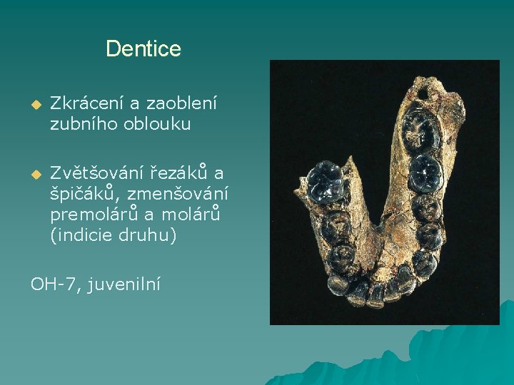 Dentice u Zkrácení a zaoblení zubního oblouku u Zvětšování řezáků a špičáků, zmenšování premolárů